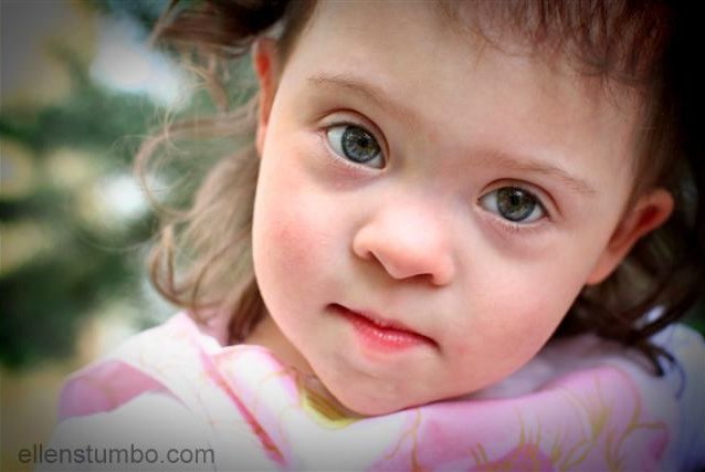 31 facts about Down syndrome - Ellen Stumbo