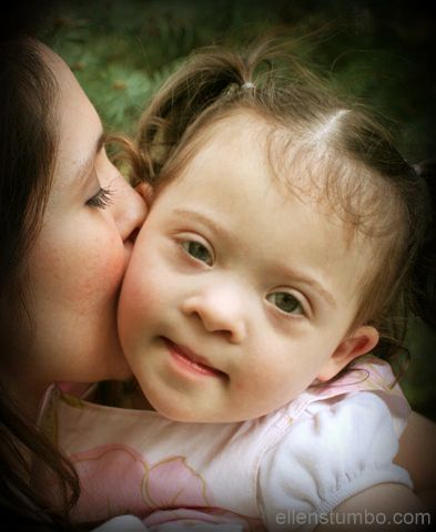 Down Syndrome and Abortion