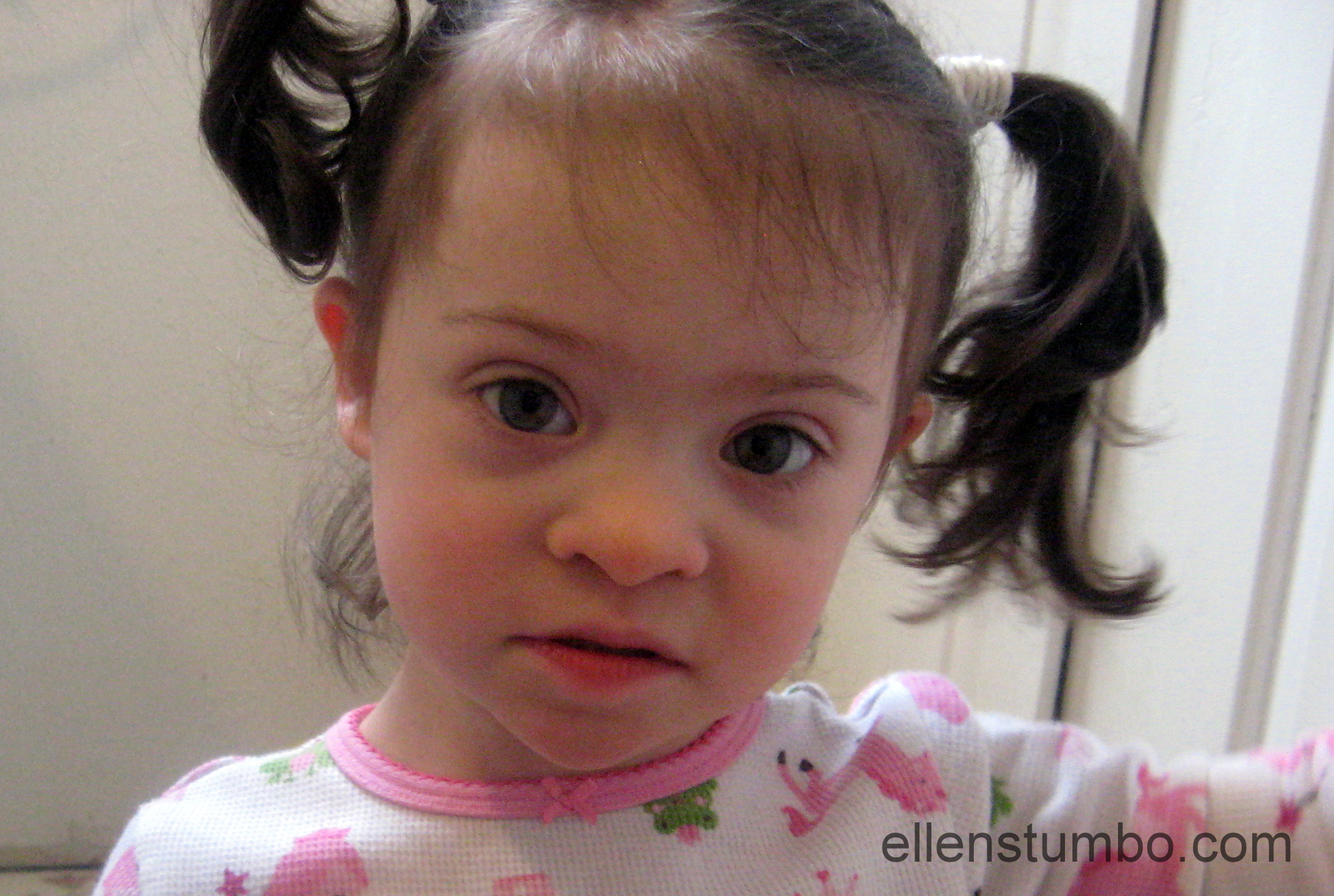 A closer look at the physical characteristics of Down syndrome - Ellen  Armendáriz Stumbo